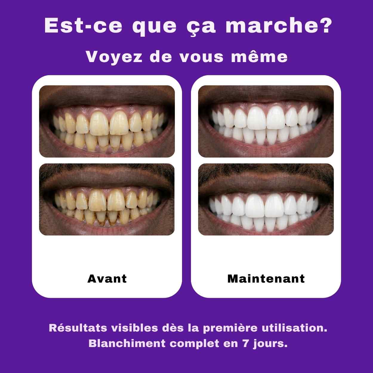 Boîte de 42 Bandes blanchissantes